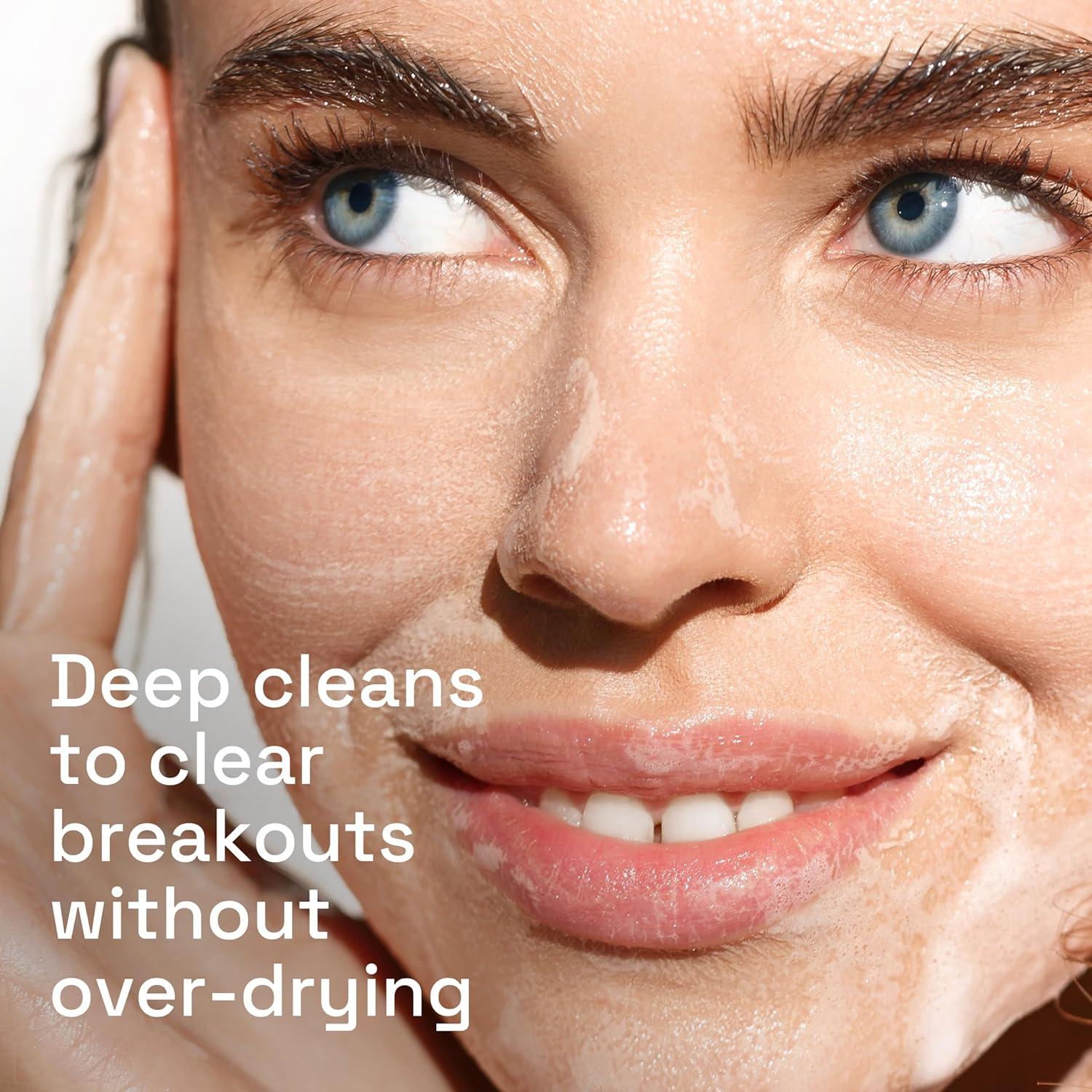 Cetaphil Gentle Clear Complexion-Clearing BPO Acne Cleanser with 2.6% Benzoyl Peroxide, Creamy and Soothing for Sensitive Skin, Suitable for All Skin Types, 4.2oz(NEW  4.2oz)