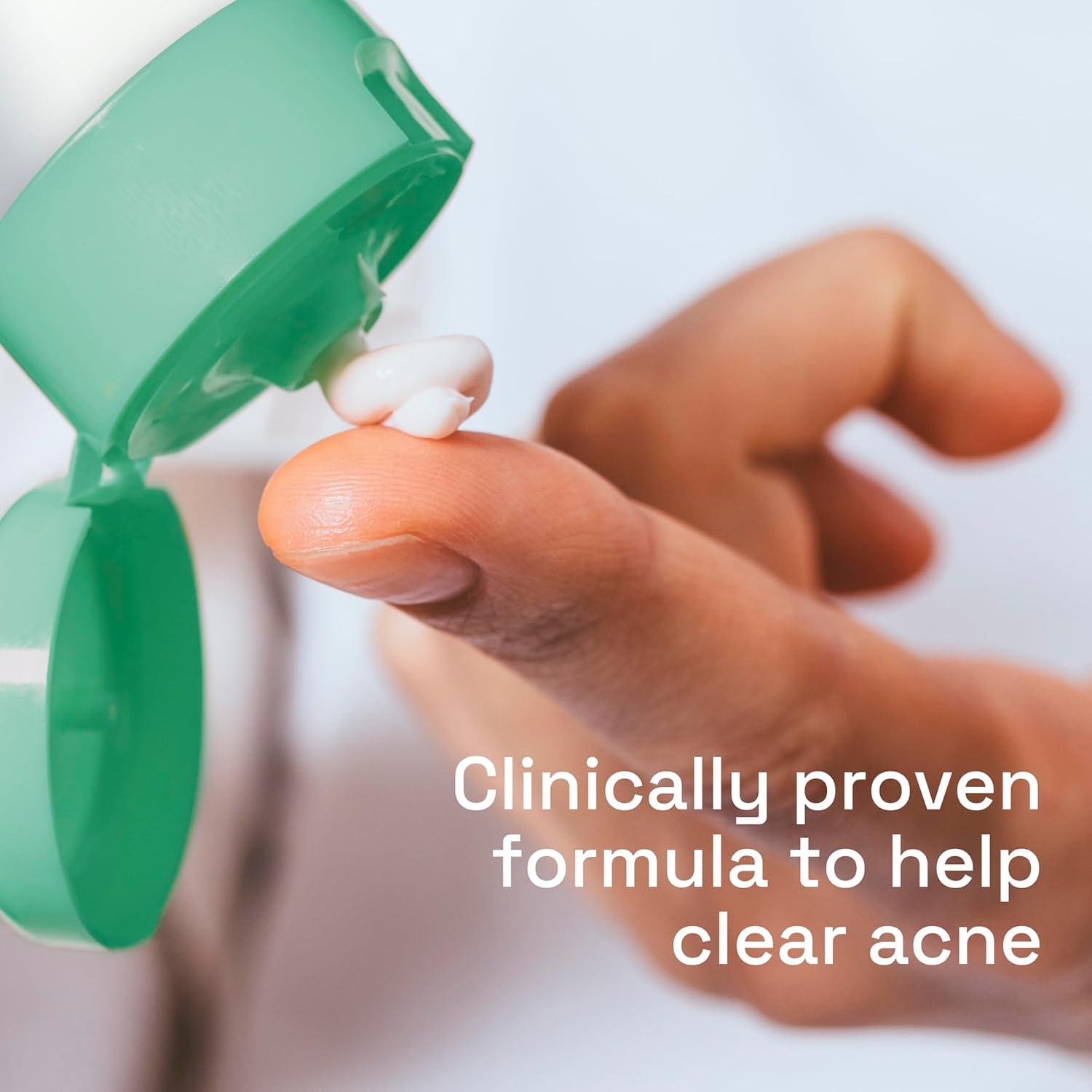 Cetaphil Gentle Clear Complexion-Clearing BPO Acne Cleanser with 2.6% Benzoyl Peroxide, Creamy and Soothing for Sensitive Skin, Suitable for All Skin Types, 4.2oz(NEW  4.2oz)
